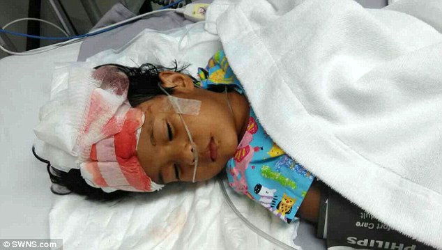 How Many Ceiling Fan Deaths Per Year